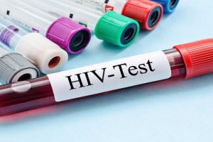7 yếu tố làm tăng nguy cơ nhiễm HIV