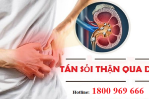 TÁN SỎI THẬN QUA DA TẠI TRUNG TÂM Y TẾ HUYỆN THANH THỦY