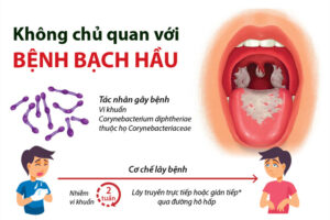 Đã có ca tử vong do bạch hầu, Bộ Y tế yêu cầu giám sát, phát hiện sớm, xử lý triệt để ổ dịch