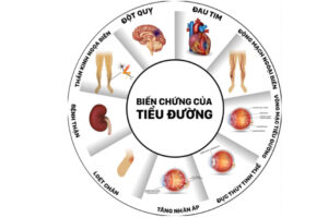 Thuốc điều trị đái tháo đường metformin nay được mở rộng sử dụng cho bệnh nhân suy thận mức độ trung bình